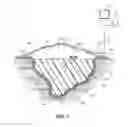 Fig. 08 - Wound dressing with vacuum reservoir