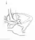Fig. 02 - Convertible Shape Catheter And Method Of Use