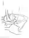 Fig. 03 - Convertible Shape Catheter And Method Of Use