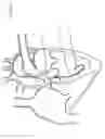 Fig. 05 - Convertible Shape Catheter And Method Of Use