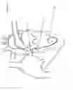 Fig. 06 - Convertible Shape Catheter And Method Of Use