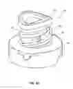 Fig. 10 - Retention feature for soft interface connection