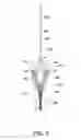 Fig. 07 - Electrode assembly for catheter system including interlinked struts