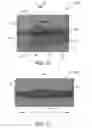 Fig. 09 - Electrode assembly for catheter system including interlinked struts