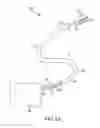 Fig. 02 - ELECTRODE ABLATION BALLOON CATHETER