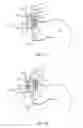Fig. 06 - Unfurling electrode devices with spring