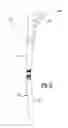 Fig. 09 - Method and apparatus for preparing an implantation site