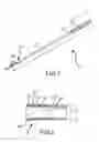 Fig. 02 - Retractable separating systems and methods