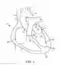 Fig. 02 - System for providing surgical access