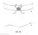 Fig. 35 - System for providing surgical access