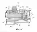 Fig. 07 - Rotational atherectomy device with exchangeable drive shaft and meshing gears