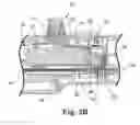 Fig. 08 - Rotational atherectomy device with exchangeable drive shaft and meshing gears