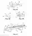 Fig. 10 - Rotational atherectomy device with exchangeable drive shaft and meshing gears