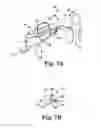 Fig. 13 - Rotational atherectomy device with exchangeable drive shaft and meshing gears