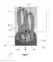Fig. 02 - Compliant surgical graspers and methods of making and using