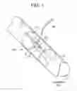 Fig. 02 - VASCULATURE CLOSURE DEVICES