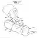 Fig. 06 - VASCULATURE CLOSURE DEVICES