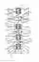 Fig. 01 - Community Orthopedic Fixation Device, System and Method