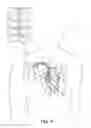 Fig. 02 - Automated phrenic nerve stimulation and pacing capture threshold test