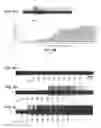 Fig. 08 - Electrical stimulation therapy for lower urinary tract dysfunction and sexual reflex dysfunction