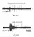 Fig. 09 - Electrical stimulation therapy for lower urinary tract dysfunction and sexual reflex dysfunction
