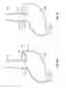 Fig. 16 - System and methods for electrical stimulation of biological systems