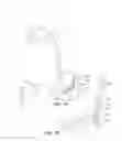 Fig. 02 - Responsive gastric stimulator