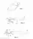 Fig. 07 - Responsive gastric stimulator