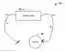 Fig. 01 - SYSTEMS AND METHODS THAT PROVIDE ELECTRICAL STIMULATION TO A NERVE TO REDUCE A REFLEX THAT AFFECT A BODILY FUNCTION