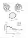 Fig. 04 - System for stimulating a hypoglossal nerve for controlling the position of a patient's tongue