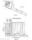 Fig. 06 - System for stimulating a hypoglossal nerve for controlling the position of a patient's tongue