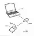 Fig. 52 - System for stimulating a hypoglossal nerve for controlling the position of a patient's tongue