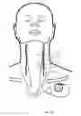Fig. 17 - Implantable neurostimulator-implemented method utilizing multi-modal stimulation parameters