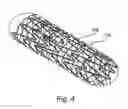 Fig. 05 - Stent-mesh assembly and methods