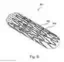 Fig. 10 - Stent-mesh assembly and methods