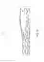 Fig. 49 - Support for treating vascular bifurcations