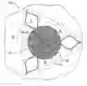 Fig. 01 - HEART VALVE REPAIR SYSTEM