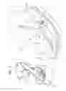 Fig. 04 - HEART VALVE REPAIR SYSTEM