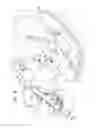 Fig. 06 - HEART VALVE REPAIR SYSTEM