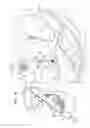 Fig. 07 - HEART VALVE REPAIR SYSTEM