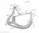 Fig. 01 - Stented prosthetic heart valve