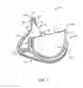 Fig. 02 - Stented prosthetic heart valve