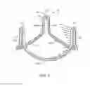 Fig. 09 - Stented prosthetic heart valve