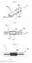 Fig. 11 - FILLER FOR REMOVING WRINKLES