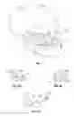 Fig. 04 - SYSTEM AND METHOD FOR PERFORMING MINIMALLY INVASIVE FACELIFTS