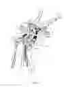 Fig. 02 - Surgical access system and related methods
