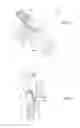 Fig. 17 - Surgical access system and related methods