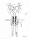 Fig. 29 - Surgical access system and related methods