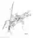 Fig. 30 - Surgical access system and related methods