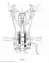 Fig. 34 - Surgical access system and related methods